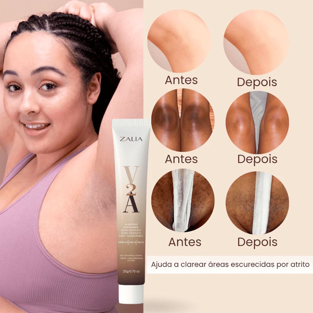 Mulher feliz ap�s usar o Hidratante Clareador V2A 20g com imagens comparativas de Antes e Depois do clareamento de axila, virilha e �nus, mostrando a frase Ajuda a clarear �reas escurecidas por atrito.